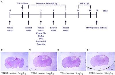 Losartan Treatment Could Improve the Outcome of TBI Mice